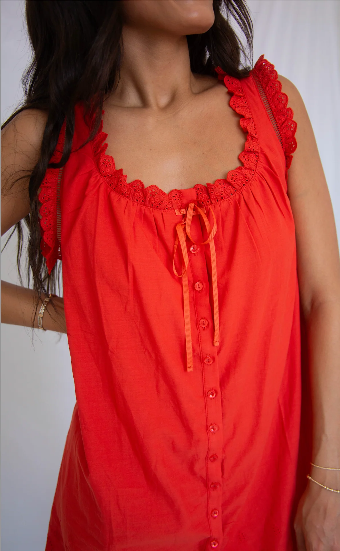 sunny social mini dress - Image 2